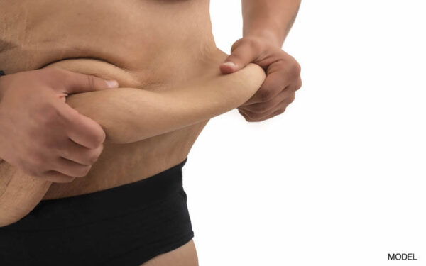 Post-Bariatric Body Contouring Post-Bariatric Body Contouring Surgery